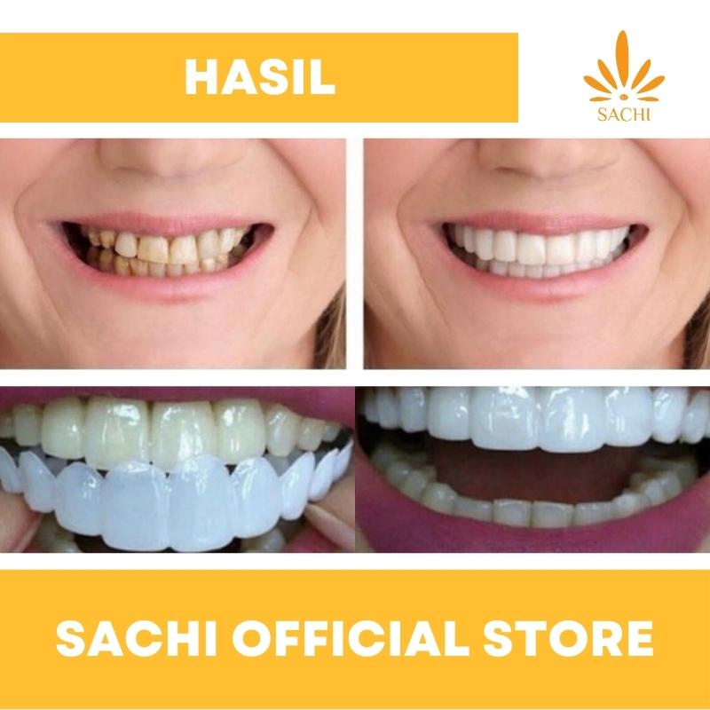 Veneer Vener Gigi Snap On Smile Authentic Perawatan Kesehatan Gigi Palsu Renggang Snapon Smile 1 Set 100% ORI
