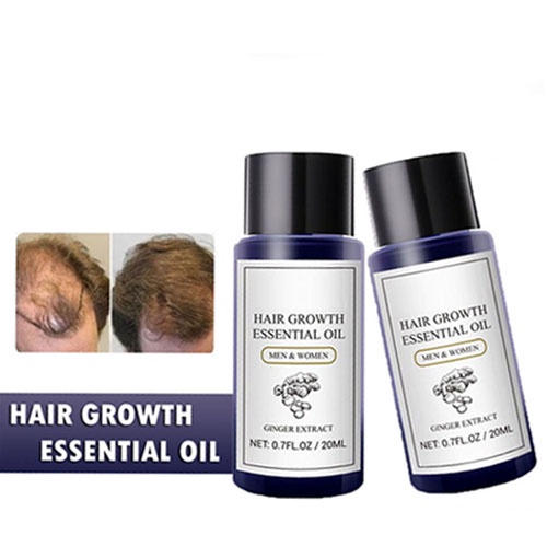 Hope Store - Serum Rambut Hair Growth Oil Mencegah Kerusakan Dan Kerontokan Rambut 100% Original
