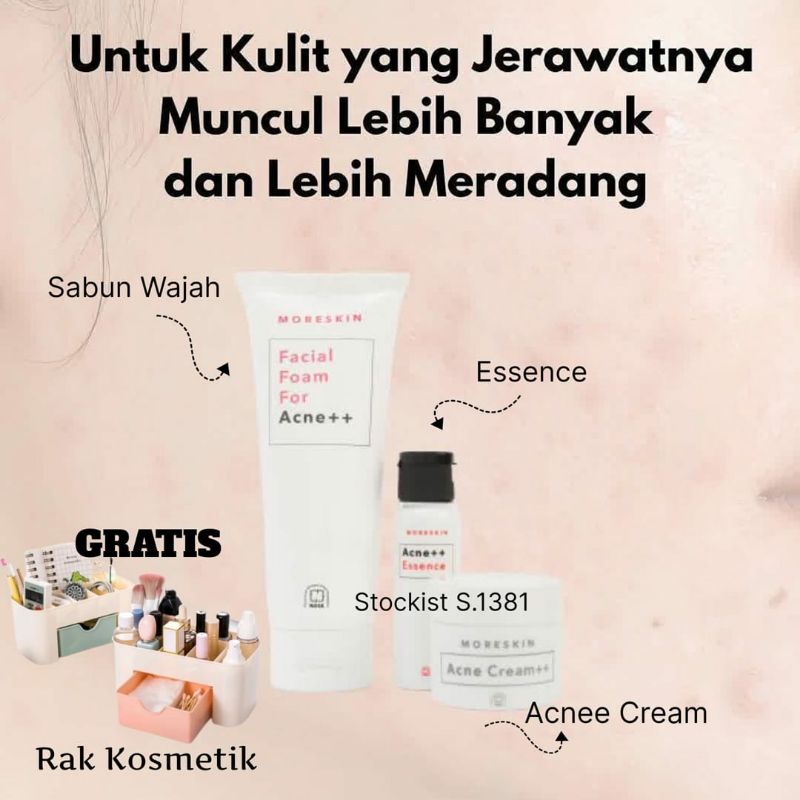 ACNE SERIES NASA//skincare untuk jerawat meradang