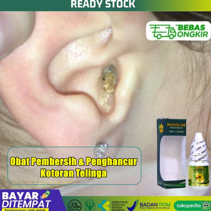 

Sale Obat Pembersih dan Penghancur Kotoran Telinga Keras - PROPOLIS SM /OBAT TELINGA BERDENGUNG/OBAT TELINGA BERAIR/OBAT TELINGA TERSUMBAT/OBAT TELINGA BUDEG/OBAT TELINGA BERNANAH