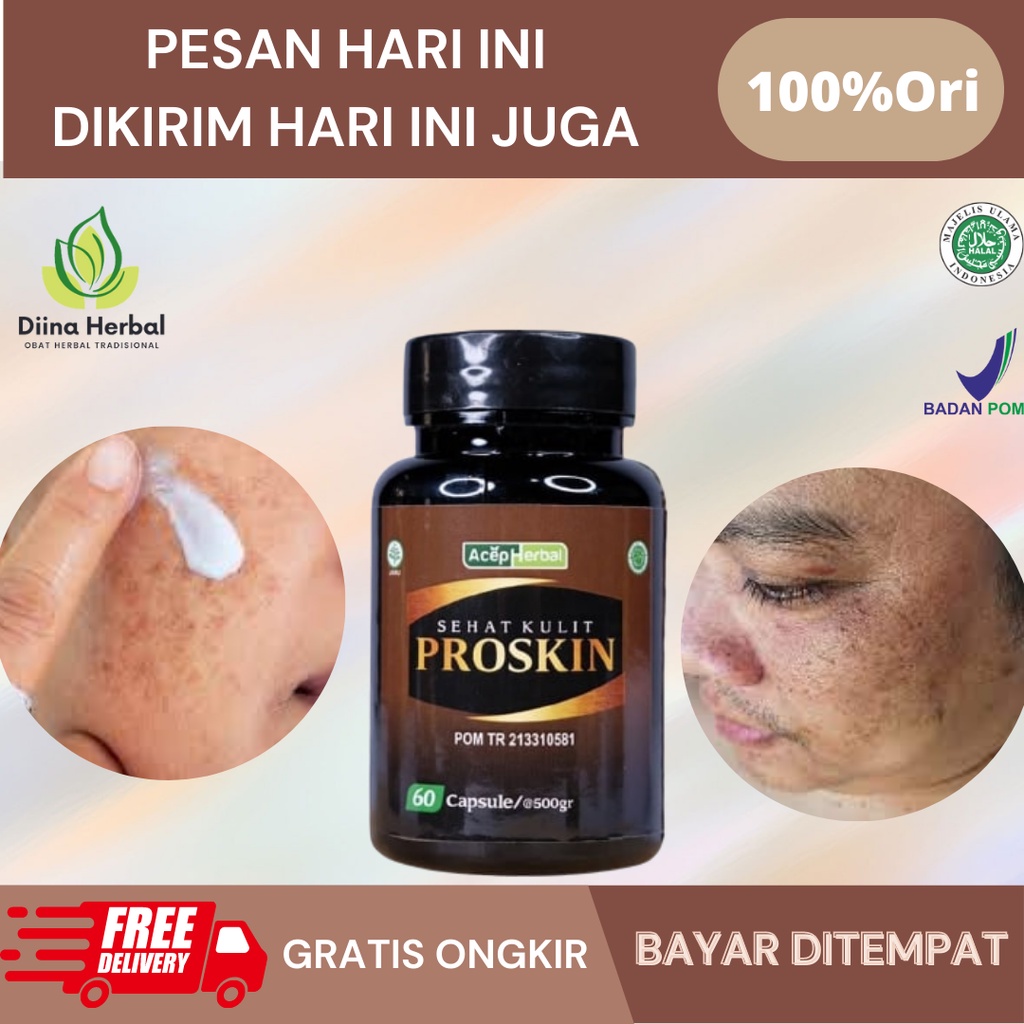 Obat Flek Hitam Membandel, Obat Penghilang Flek Hitam, Obat Anti Penuaan, Obat Komedo Di Hidung, Oba