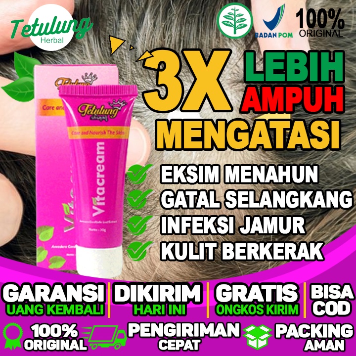 Salep Gatal Pada Kepala Salep Gatal Pada Kulit Eksim Menahun Dan Infeksi Jamur