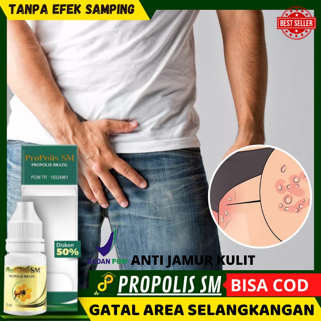 Salep Gatal Selangkangan Paling laris - Salep cair Gatal Kulit Jamur - Obat Salep Gatal Kulit - Sale