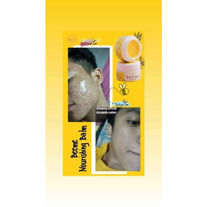 Beeme Nourishing Balm Pelembab Serbaguna BPOM ORIGINAL Bayi Remaja Dewasa Friendly - READY MAKASSAR