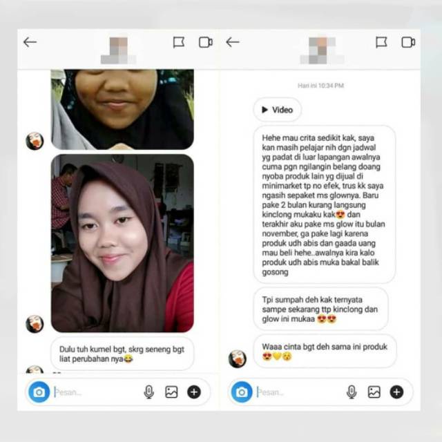 MS Glow Paket Whitening - 4 item - Free Pouch Abu