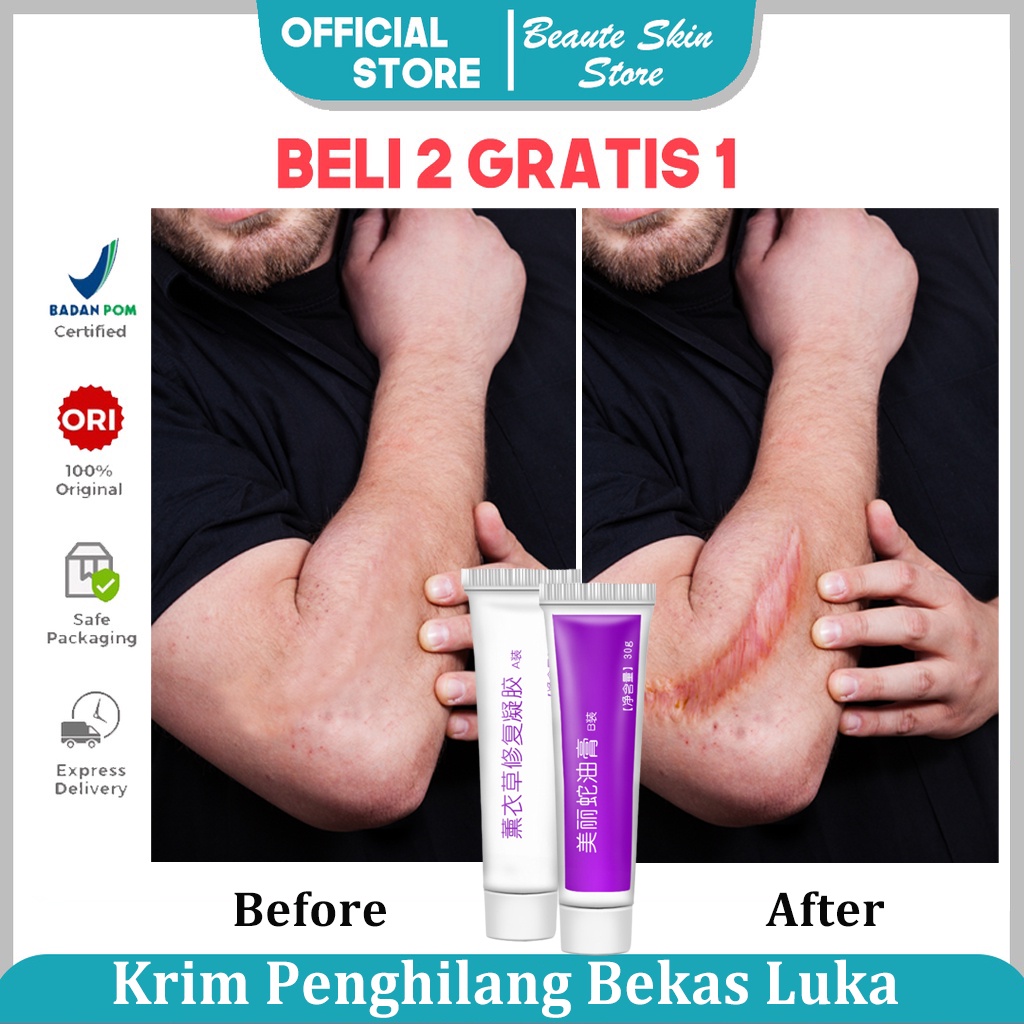 【Barang spot】cream penghilang bekas luka jerawat hitam koreng menghilangkan bekas jerawat sabun penghilang bekas luka serum penghilang bekas jerawat dermatik penghilang bekas luka salep bekas luka obat menghilangkan bekas luka