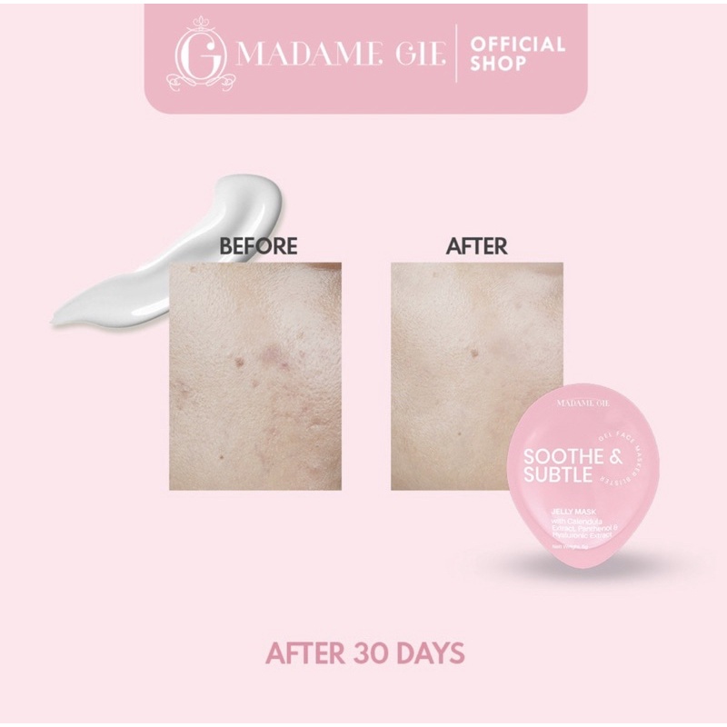 Madame Gie Jelly Mask - Skin Care Gel Masker Wajah