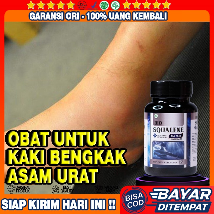 Obat Kaki Bengkak Karena Asam Urat - Obat Jantung Bengkak - Obat Ginjal Bengkak - Obat Penyakit Gula