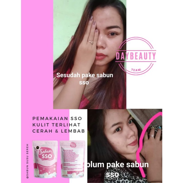 SABUN SSO (Susu Sereh Original)