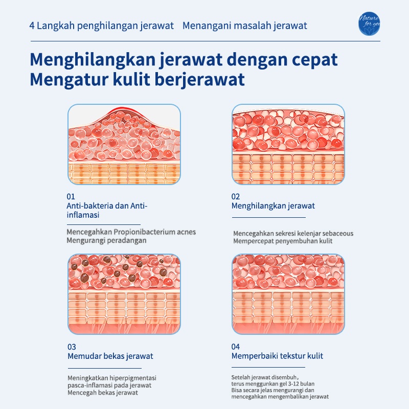 cream jerawat obat totol jerawat krim jerawat obat jerawat dan bekas jerawat Jerawat Removal of Acne Cream Untuk Pria dan Wanita Menghilangkan jerawat dengan cepat