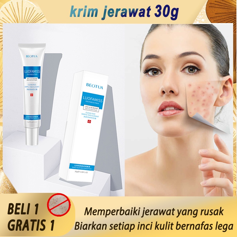 Cream jerawat,bekas jerawat,krim jerawat,Secara efektif menghancurkan jerawat Memperbaiki jerawat ya