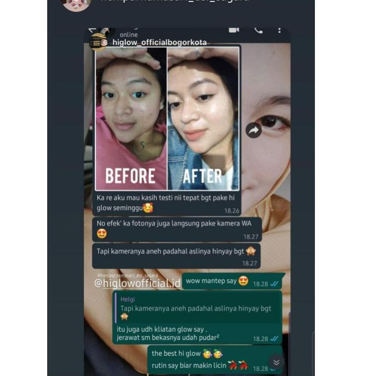 SIAP KIRIM HI GLOW SKINCARE GlOW REMOVE SPOT ACNE DARK SPOT ACNE PRONE HIGLOW KOSMETIK BPOM GLOWING 