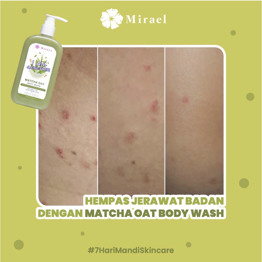 MIRAEL ALL VARIANT BODY WASH 340ML