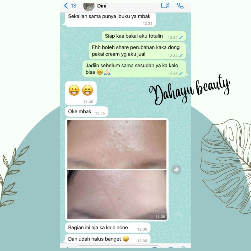 THERASKIN PAKET HEMAT ACNE WHITENING EXPRESS