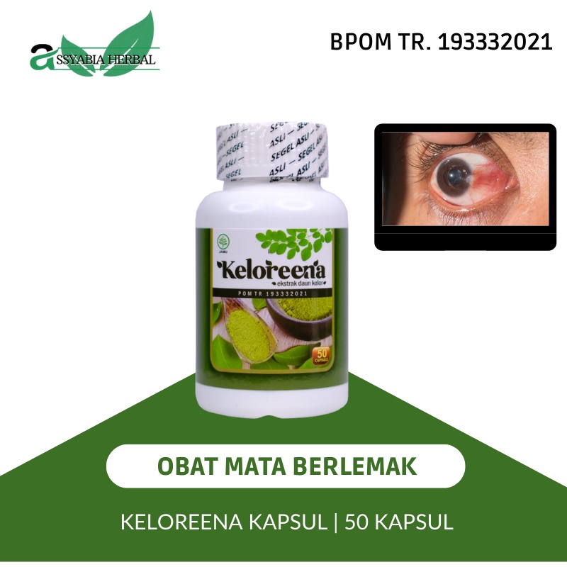 Obat Bola Mata Mata Berlemak Pterygium Pterigium Surfer's eye