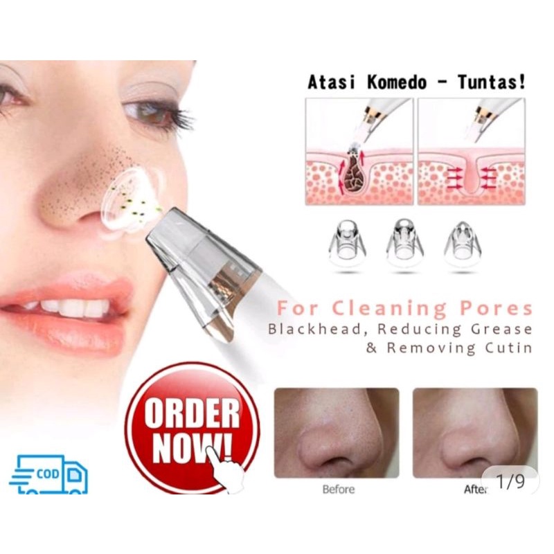 [ BISA COD ] Alat Penyedot Komedo /Komedo Vacum /Alat sedot Komedo /Alat Komedo Facial