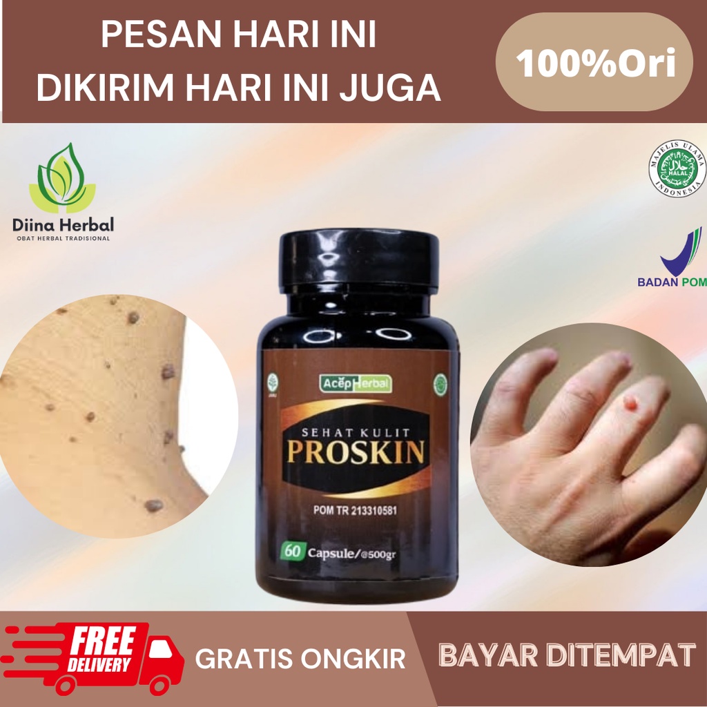Obat Perontok Kutil, Obat Penghilang Kutil Papiloma, Obat Papiloma Di Leher, Obat Kutil Oles Kelamin