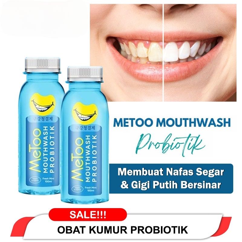 [ BPOM - HALAL ] OBAT KUMUR METOO FRESH MINT MOUTHWASH PROBIOTIK &amp; ANTISEPTIC