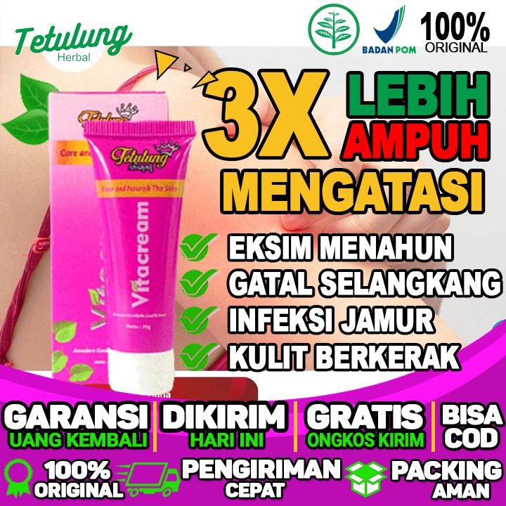 Obat Salep Untuk Gatal Bernanah Obat Salep Untuk Gatal-gatal Pada Kulit Dan Eksim Menahun