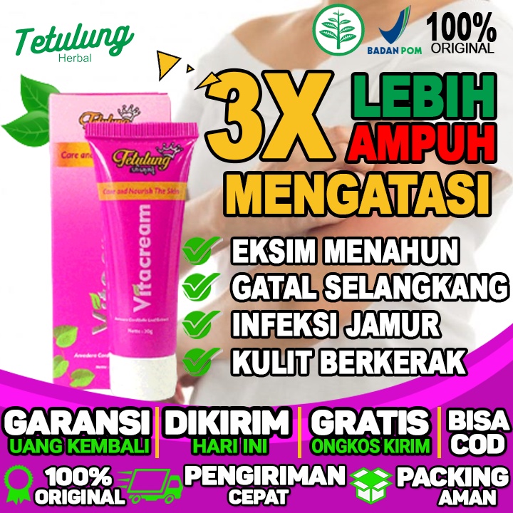 Salep Gatal Kulit Salep Gatal Selangkangan Salep Gatal Jamur Dan Eksim Menahun