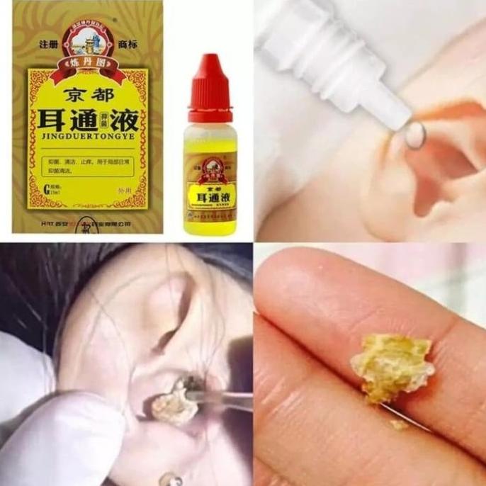 Sale Obat Tetes Telinga Herbal Cina untuk Perawatan Tuli Otitis Tinnitus /OBAT TELINGA BERDENGUNG/OB