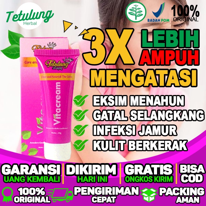 Salep Untuk Gatal Alergi Udang Salep Untuk Tangan Gatal Berair Salep Untuk Untuk Gatal Gatal Dan Eks