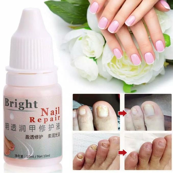 OBAT KUKU RUSAK KUKU CANTENGAN DAN KUKU JAMURAN