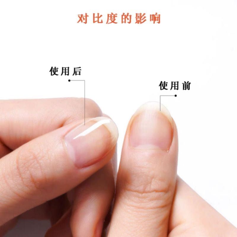 Medan Termurah N+ Vitamin Kuku Minyak Kuku Cuticle Revitalizer Oil