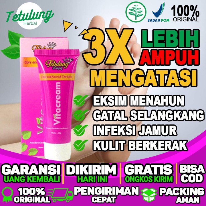 Salep Untuk Gatal Dan Bengkak Salep Untuk Gatal Di Leher Salep Untuk Gatal Di Kemaluan Pria/wanita