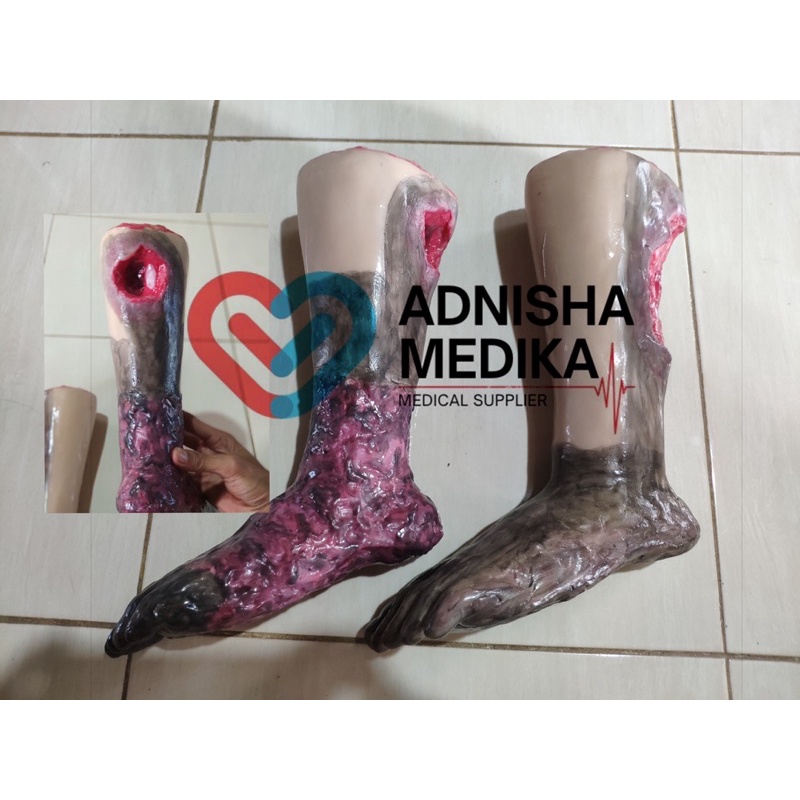 PHANTOM MANIKIN KAKI LUKA DECUBITUS
