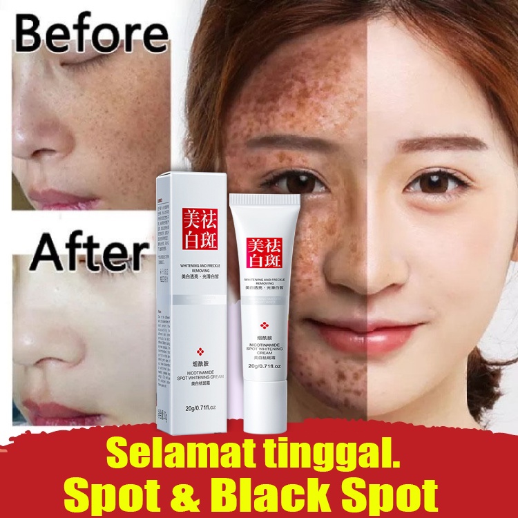 Obat Flek Hitam Bandel Krim PencerahMenghilangkan Melasma Dark Spot Serum 20g DARK SPOT PORE AWAY Treatment Darkspot Serum