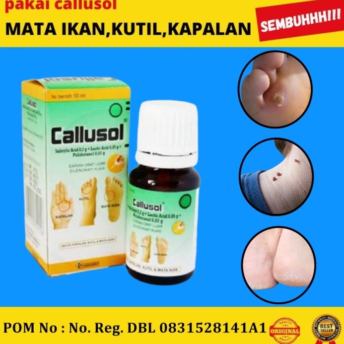 CALLUSOL ORIGINAL OBAT MATA IKAN, KUTIL, KAPALAN