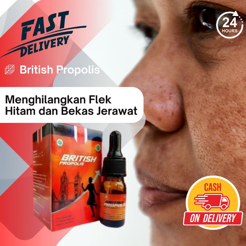 British Propolis 6ml Flek Hitam Dewasa Bekas Jerawat Batu Bruntusan Wajah Kusam dan Berminyak Bintik