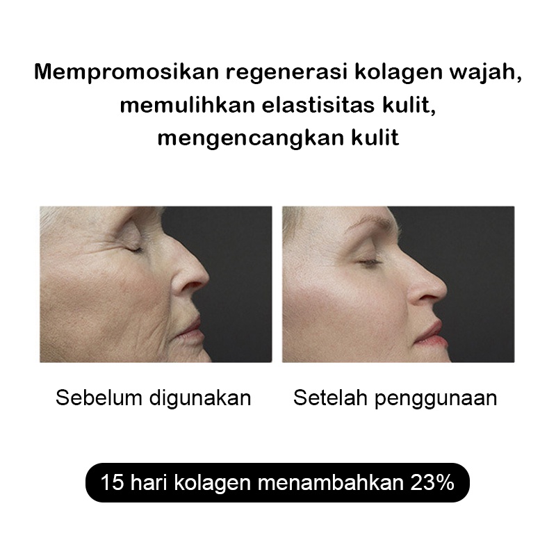 2023 Newest Mini HIFU RF EMS PULSE 4 in 1 Alat Kecantikan Multifungsi EMS Radio Frekuensi Ultrasonik Pulse Penghapusan Kerutan Wajah Lingkaran Hitam Pemutih Kencangkan Kulit Beauty Face