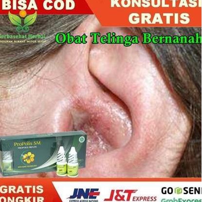 

Discount Obat Telinga Bau Busuk,Bernanah,Gatal, Berair,Infeksi Telinga,Propolis /OBAT TELINGA BERDENGUNG/OBAT TELINGA BERAIR/OBAT TELINGA TERSUMBAT/OBAT TELINGA BUDEG/OBAT TELINGA BERNANAH