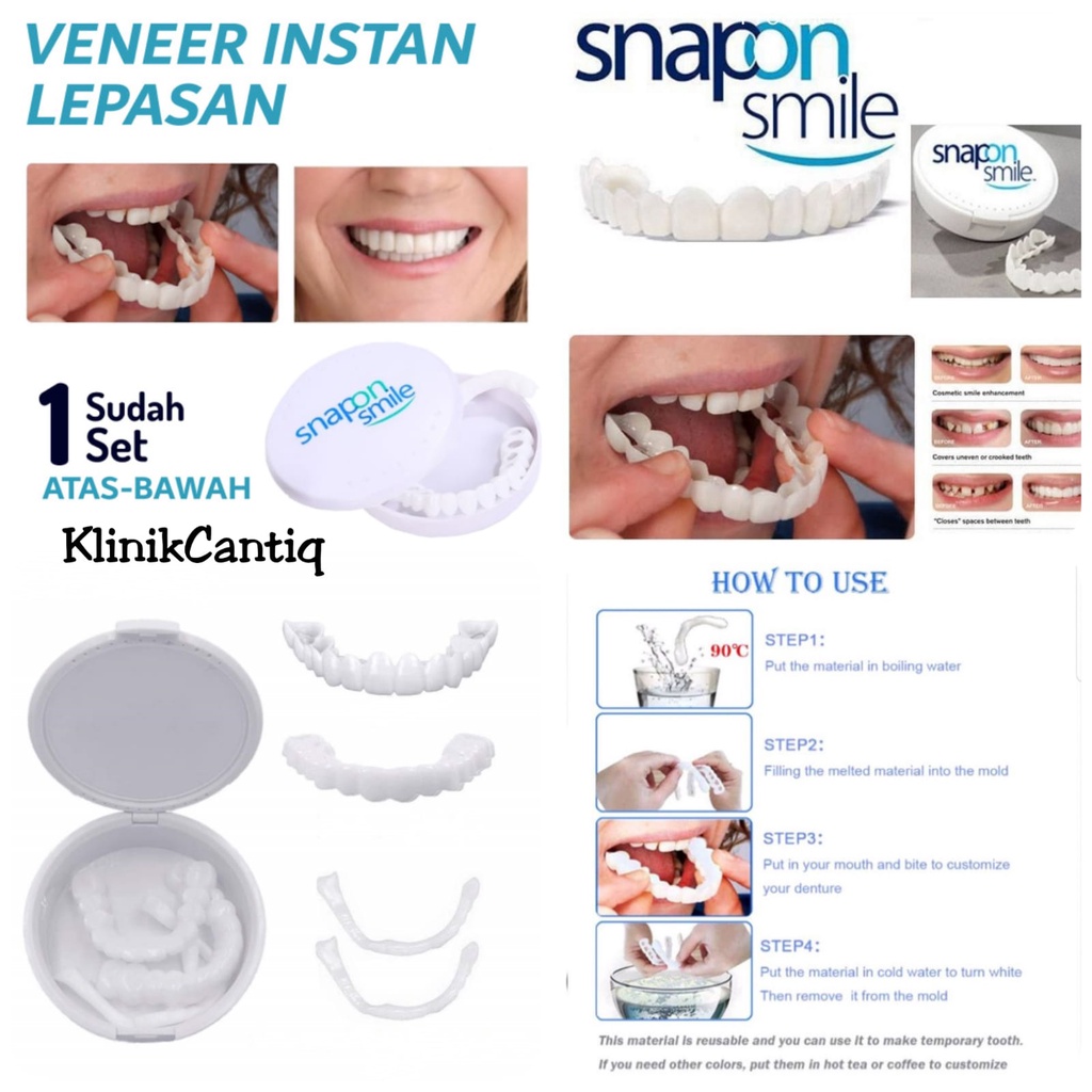 Snapon Smile Removable Veneer Teeth Instan Snap On Gigi Palsu Original