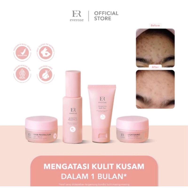 Everose Essential Series Starter Kit Paket / Satuan Facial Wash / Soft Peel / Day Cream / Night Cream Essentials Series