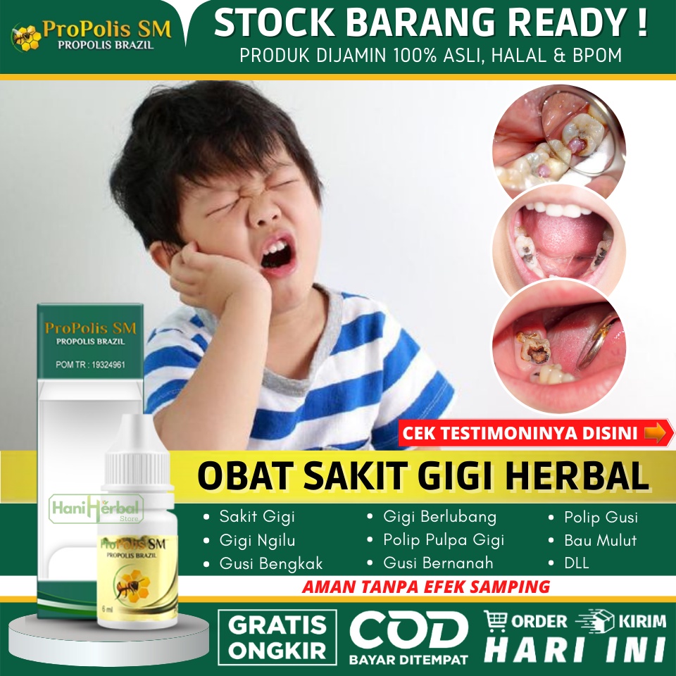 Propolis SM 100% Asli - Obat Polip Gigi Pada Anak Alami, Polip Pulpa di Gigi, Polip Gusi, Daging Tum