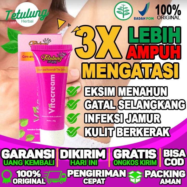 Obat Salep Gatal Kulit Paling Ampuh Salep Gatal Lecet Di Selangkangan dan hitam di ketiak