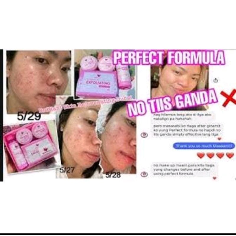 brilliant perfect/exfoliating mild(menghilangkan flex, noda bekas jerawat, komedo putih, komedo