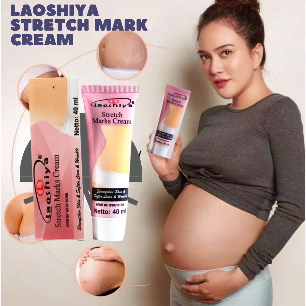 ￼LAOSHIYA STRETCH MARKS CREAM ORIGINAL BPOM SOLUSI TERBAIK MENGHILANGKAN STRETCH MARK
