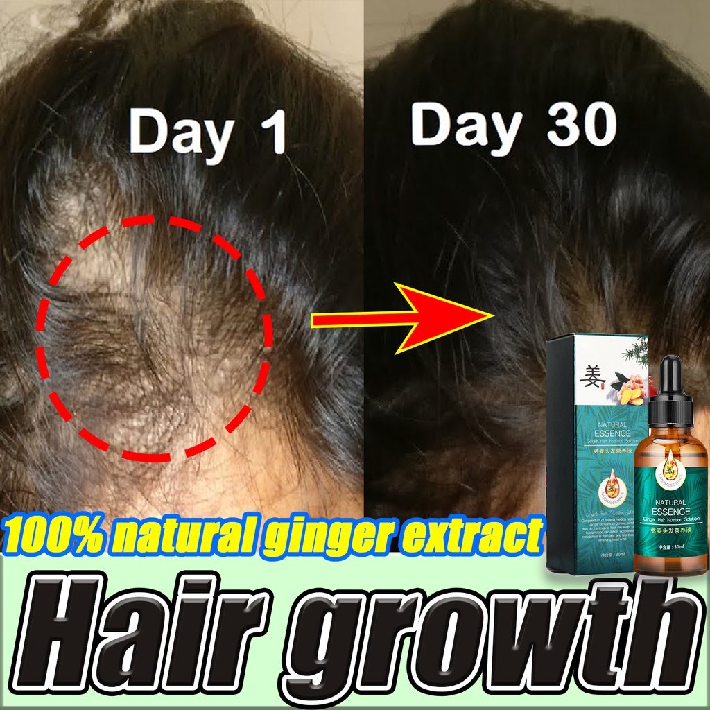 【Barang Spot】Esensi Pertumbuhan Rambut Minyak Penumbuh Rambut Esensi Perawatan Rambut Jahe Anti Rambut Rontok Menyehatkan Kulit Kepala Perawatan Rambut Esensi Pertumbuhan Rambut Jahe Ginger Hair Growth Essence Hair Care