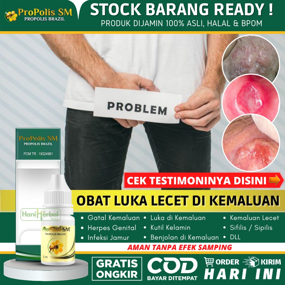 Obat Oles Untuk Penis Gatal & Bruntusan 100% Alami & Aman, Penis Lecet dan Gatal, Ruam Merah di Area