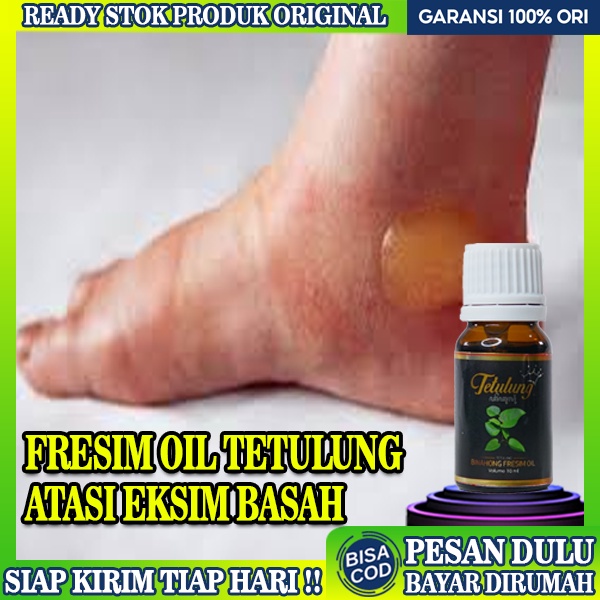 Jual Obat Eksim Basah Paling Ampuh Obat Gatal Eksim Basah Fresim Oil Ml Obat Oles Obat