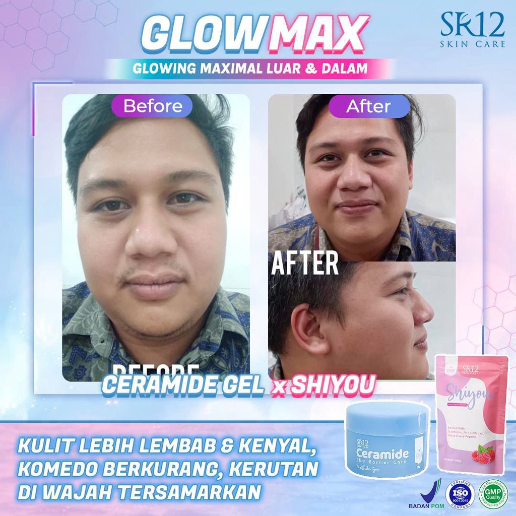 SR12 Ceramide Skin Barrier Care 18gr Pelembab Wajah Melembabkan Mencerahkan Kulit Muka BPOM