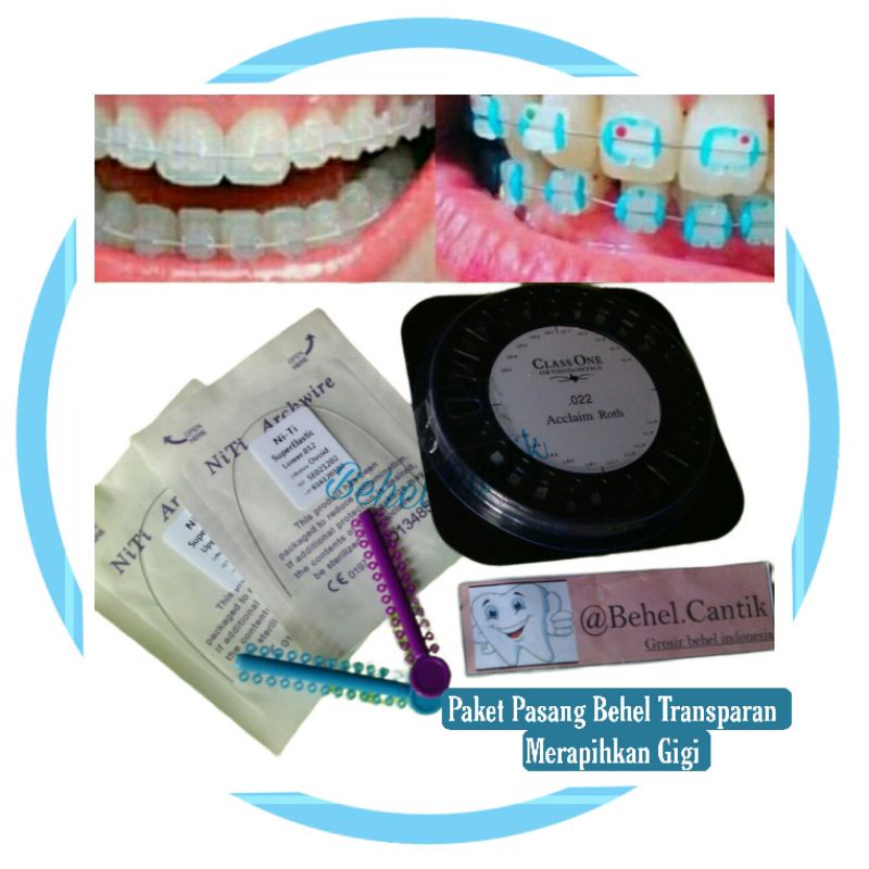 Paket Behel Gigi Transparan Ceramic Classone Behel Merapihkan Gigi Siap Pasang Sendiri Ke Dokter Gig