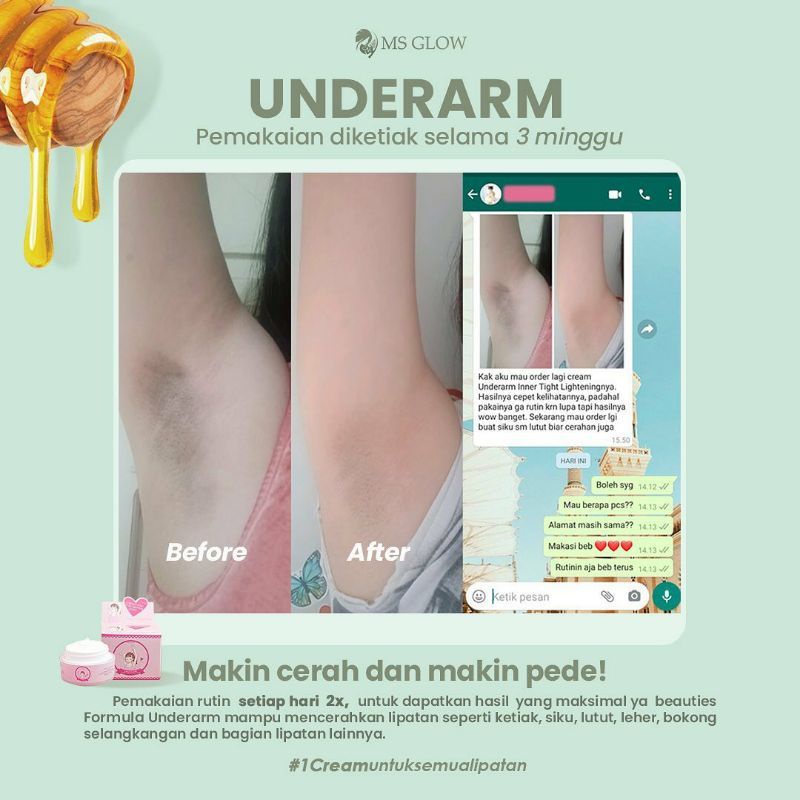 UNDERARM MS Glow Original ber Barcode Pemutih Ketiak selangkangan hitam termurah bisa cod