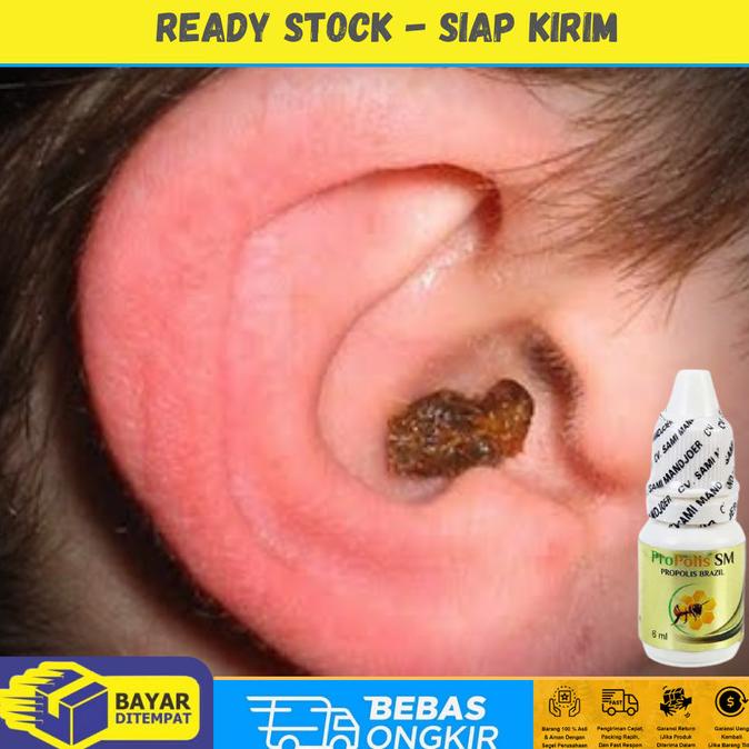 

TERLARIS Propolis SM 6ml - Obat Penghancur Kotoran Telinga Keras /OBAT TELINGA BERDENGUNG/OBAT TELINGA BERAIR/OBAT TELINGA TERSUMBAT/OBAT TELINGA BUDEG/OBAT TELINGA BERNANAH