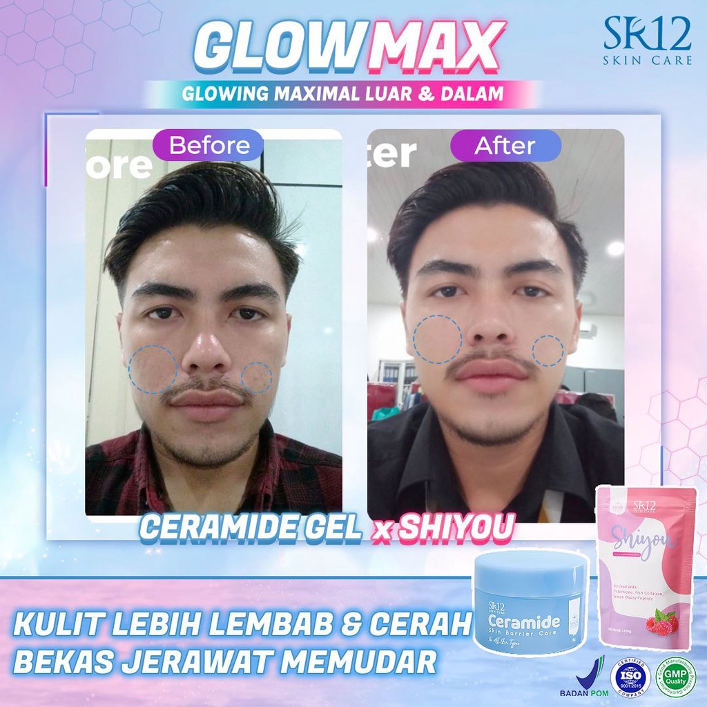 Shiyou Collagen SR12 Minuman Collagen Mencerahkan Kulit Pemutih Badan BPOM