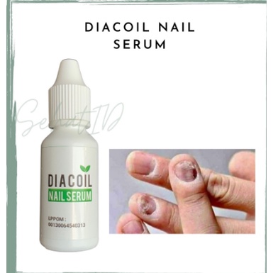 DIACOIL SERUM KUKU OBAT PENGHILANG JAMUR KUKU CANTENGAN KUKU